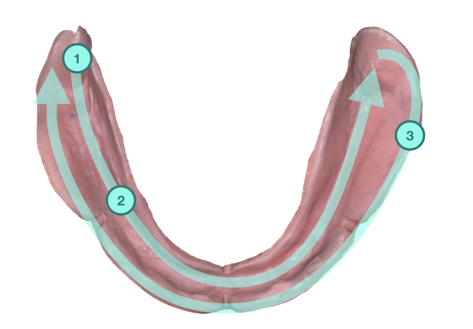 How to scan edentulous cases with the i500
